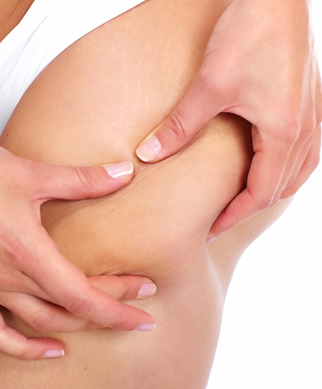 Pressoterapia - Estetica Il Sole Mestre